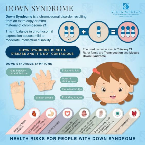 Down Syndrome infographic for physical features.